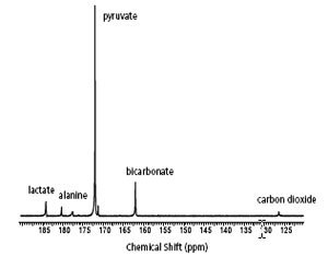 Carbon-13 NMR spectrum of a perfused mouse heart following injection