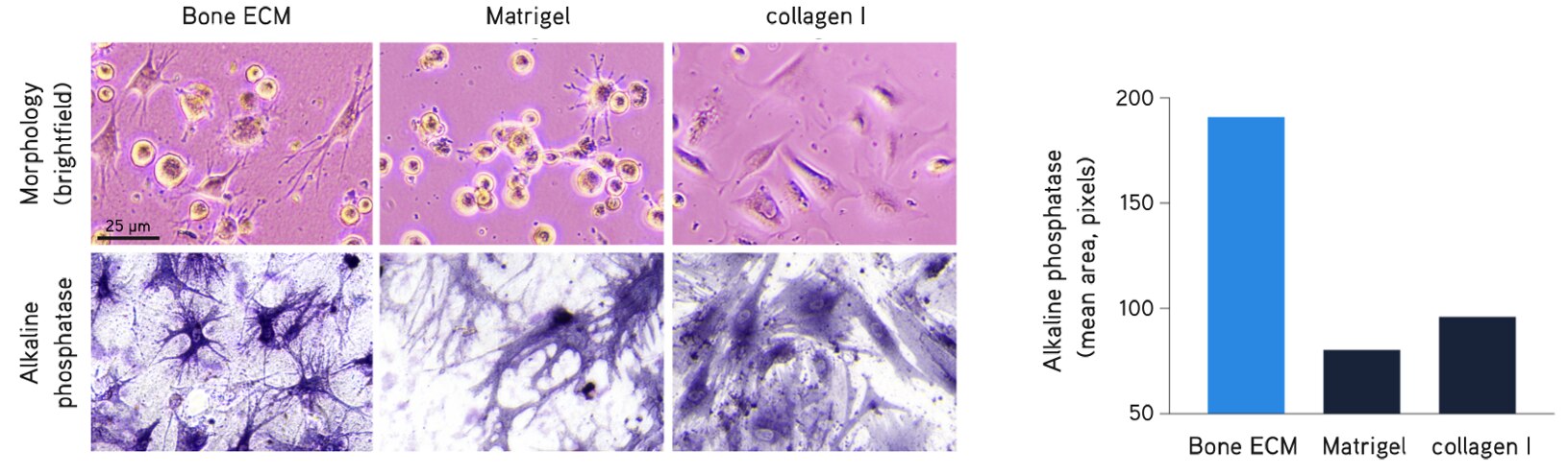 Primary human osteoblasts culture.