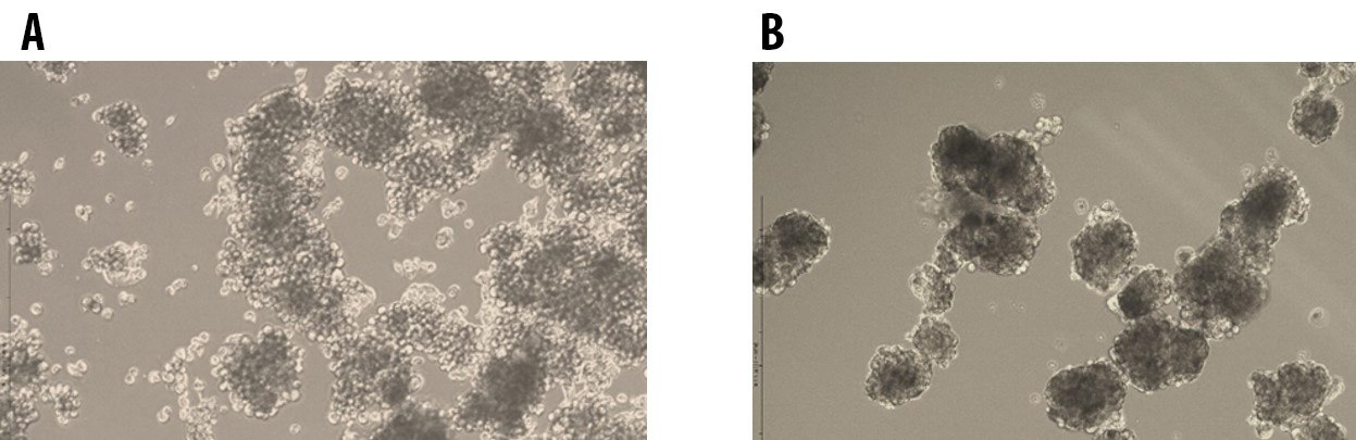 Tumorsphere formation of E006AA Prostate Cancer Cells at Passage