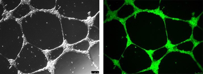 Angiogenesis tube formation using ECM Gel Matrix