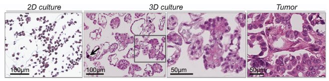 epithelial ovarian cancer cells