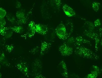 Live Cell LC3 Lentiviral Fluorescent Biosensors