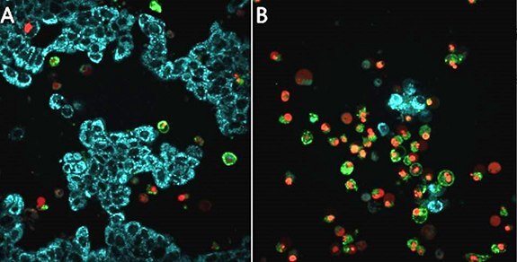 Live cell detection apoptosis in MCF-7 breast cancer cells