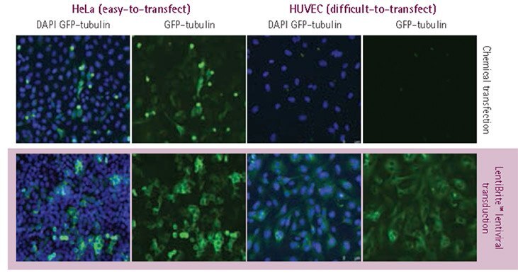 Plasmid vs. lentivirus transfection in easy- and difficult-to-transfect cell types.