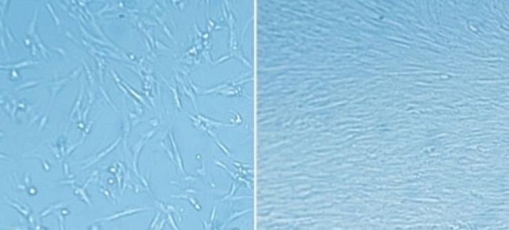 Extracellular matrix (ECM) coating enables rapid expansion of fetal lung fibroblasts.