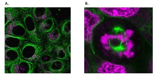 Live cell imaging of the cytoskeleton.