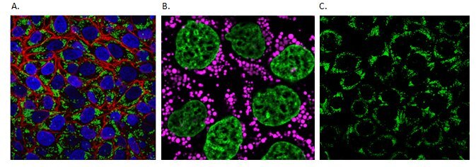 Live cell imaging of cellular lipids