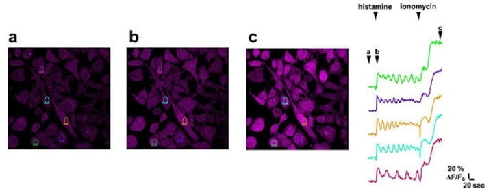 Imaging of calcium flux in cancer cells