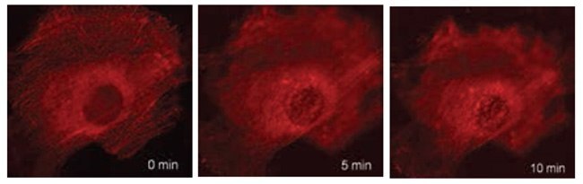 Live cell time-lapse imaging of β-actin