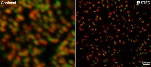 Two subunits of the nuclear pore complex were immunolabeled using antibodies against gp210 and antibodies with multiple specificities (PAN4/5) and secondary antibodies coupled to Abberior® STAR580 and Abberior® STAR635P.