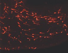 Young Migrating Neurons Labeled