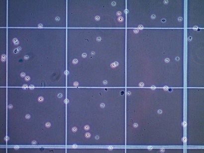 Cell Counting Using a Hemocytometer and Trypan Blue