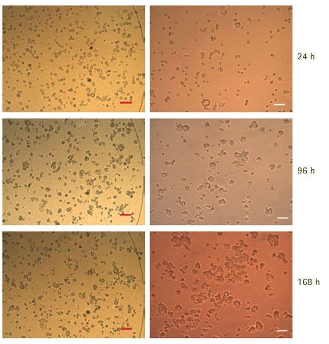 Long-term cell culture of MCF7 cells in the CellASIC® ONIX Microfluidic Platform