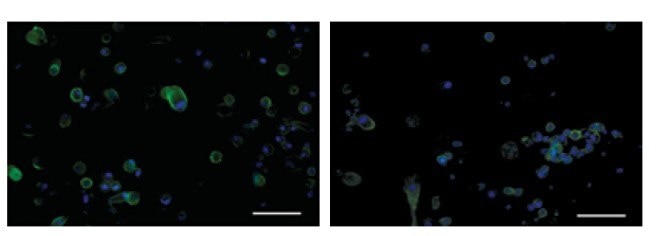 ICC for CD9, a cell surface glycoprotein, on PC-3 cells following a fixation protocol