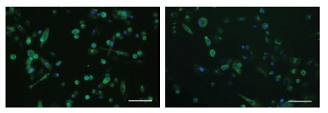 ICC for cytokeratin 19, an intracellular intermediate filament protein