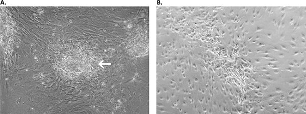 Primary culture derived from an invasive adenocarcinoma with the Primary Cancer Culture System