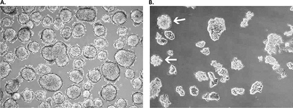 Primary culture derived from a low-grade small cell lung cancer with the Primary Cancer Culture System.