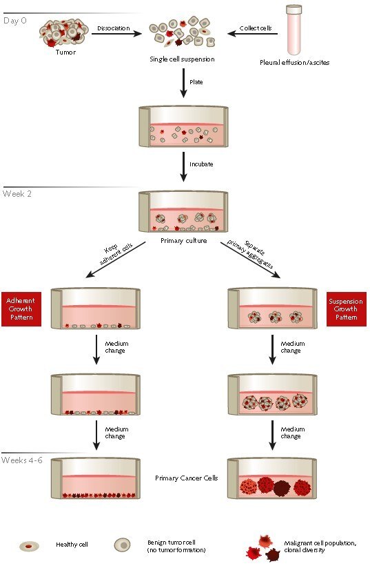 Protocol overview of the selective isolation of primary human cancer cells from patient derived tumor samples or effusions using PromoCell’s Primary Cancer Culture System.