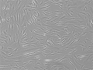 P4 bone-marrow mesenchymal stem cells grown in media containing 10% FBS