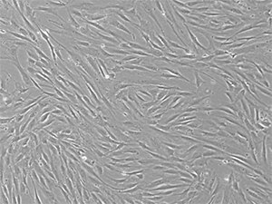 P4 bone-marrow mesenchymal stem cells