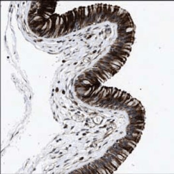 Immunohistochemical staining of human nasopharynx shows cytoplasmic and membranous positivity in respiratory epithelial cells using Prestige Antibodies® Anti-DEFA5 (Cat. No. HPA015775)