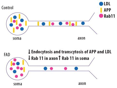 Schematic showing the results of analyzing gene-edited “Alzheimer’s neurons.”