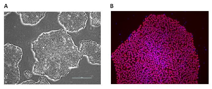 Alzheimer’s Human iPS Cell Lines