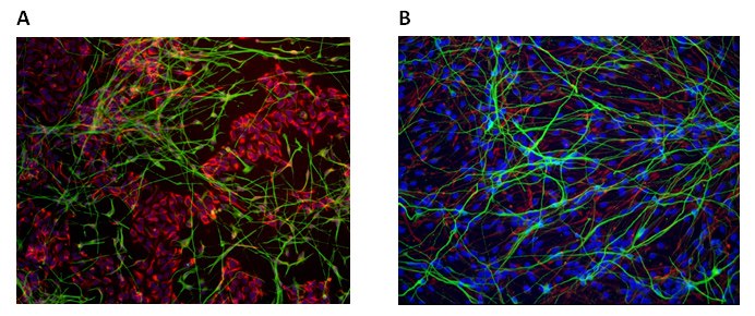 Neural Differentiation of Human iPS Cell Lines