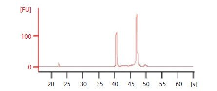 Electropherogram of total RNA