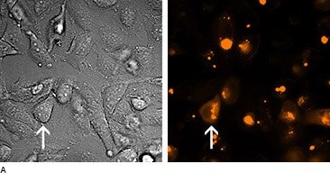 Microscopic images of treatment cells.