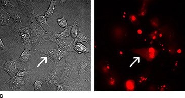 Microscopic images of treatment cells.