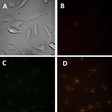 Microscopic images of control cells (treated only with transfection reagent)