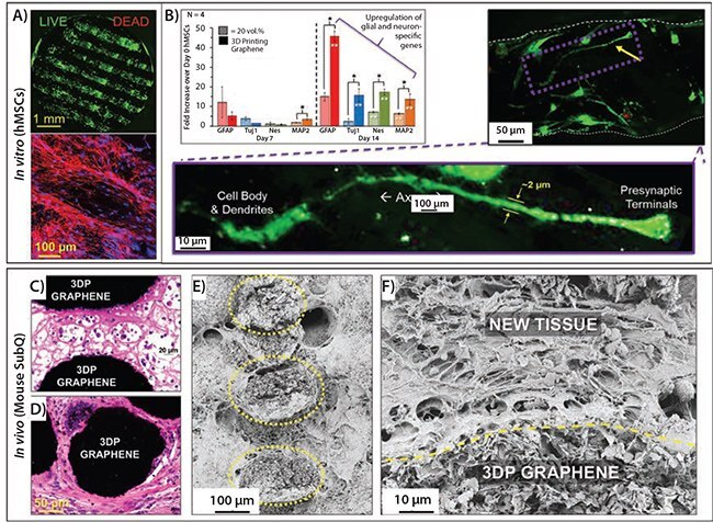 Confocal microscopy reconstruction