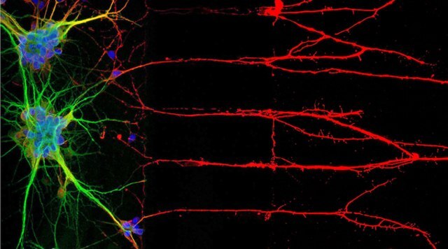 Immunocytochemistry (ICC) locates proteins associated with neuronal nuclei, soma, and axons