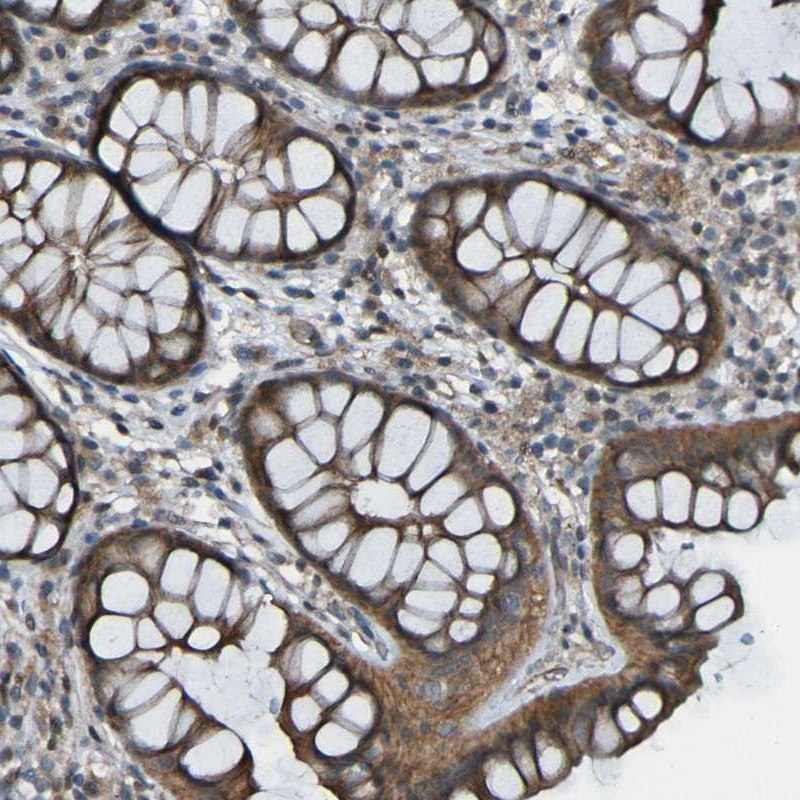 Immunohistochemical staining of human colon with anti-LGR5/GPCR49 polyclonal antibody (Cat. No. HPA012530) shows cytoplasmic positivity in glandular cells, in brown.