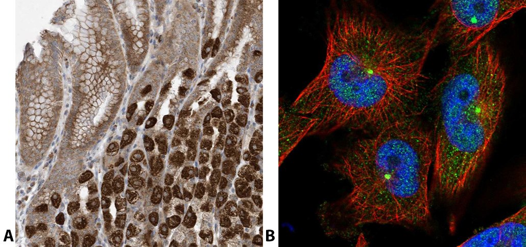 Staining with anti-C2ORF74 polyclonal antibody (Cat. No. <a href="/product/sigma/hpa026826">HPA026826</a>). (A) Immunohistochemical staining of human stomach shows strong cytoplasmic positivity in parietal cells. (B) Immunofluorescent staining of human cell line U-251 MG shows positivity in centrosome and nucleus but excluded from the nucleoli.