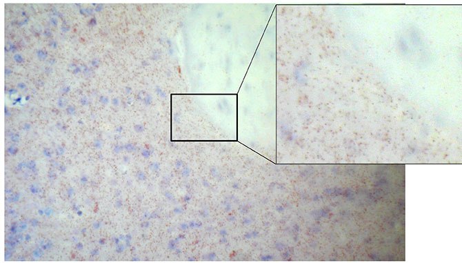 duolink brightfield detection