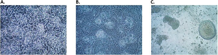 Differentiation of definitive endoderm cells into hindgut endoderm cells. Morphology of hindgut endoderm cells at A) day 2 B) day 3 and C) day 4 post hindgut endoderm induction.