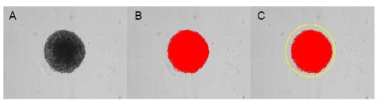 Process for analysis of spheroid expansion