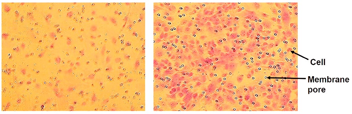 In vitro cell migration of endothelial cells stimulated by VEGF.