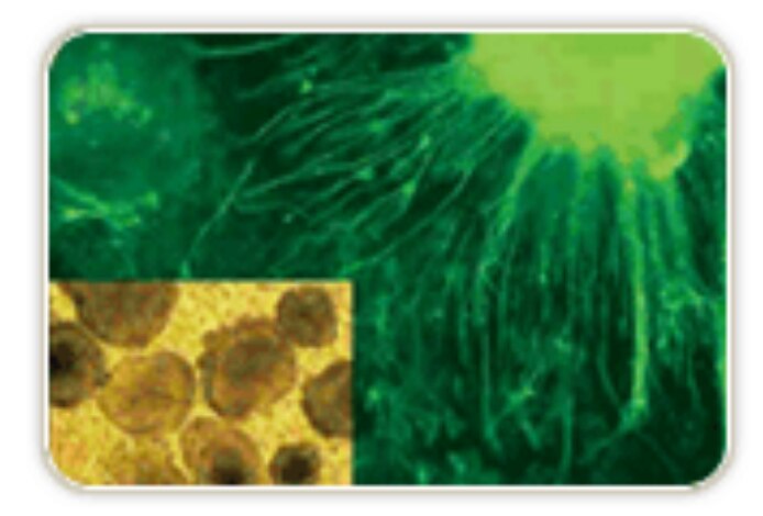 Living murine embryonic stem cell derived embryoid bodies visualized in a 1 um PET Millicell®-24 device using an Olympus IMT-2 inverted microscope