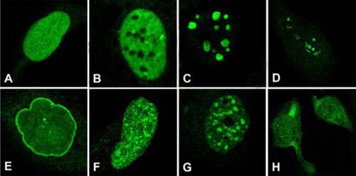 Diversity of nuclear staining patterns