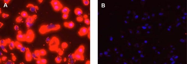 Detection of Her2 in FFPE preparations of SKBR-3 high expression cells using Duolink® PLA