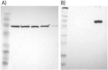 Examples of supportive WB images showing single bands corresponding to predicted sizes in kDa (+/-20%).