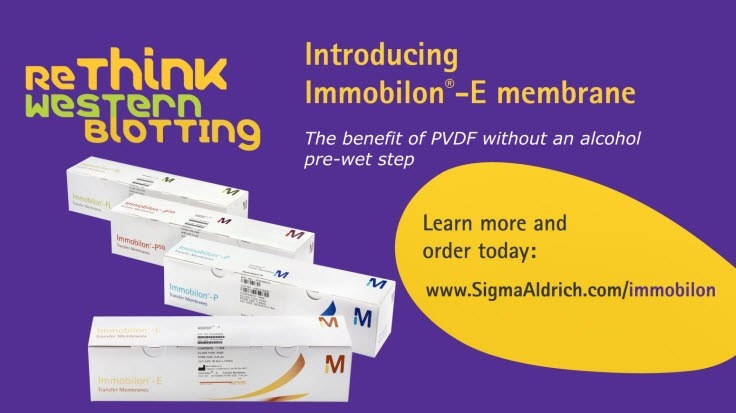 Immobilon<sup>®</sup>-E PVDF membrane for Western blotting