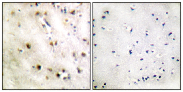 Anti-TISB antibody produced in rabbit affinity isolated antibody