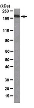 Anti-Werner&#8242;s syndrome helicase (WRN) Antibody, clone 20A11.1 clone 20A11.1, from mouse