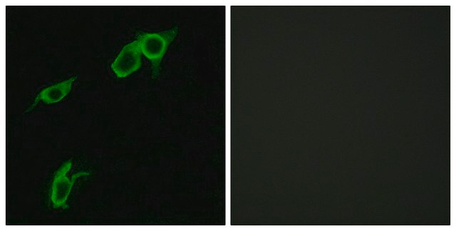 Anti-GPR75 antibody produced in rabbit affinity isolated antibody