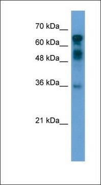 Anti-CXORF67 antibody produced in rabbit affinity isolated antibody