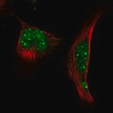 Anti-RNF4 antibody produced in rabbit Prestige Antibodies&#174; Powered by Atlas Antibodies, affinity isolated antibody, buffered aqueous glycerol solution